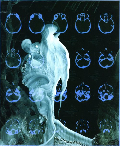 Virgil Grotfeldt Virgil Grotfeldt